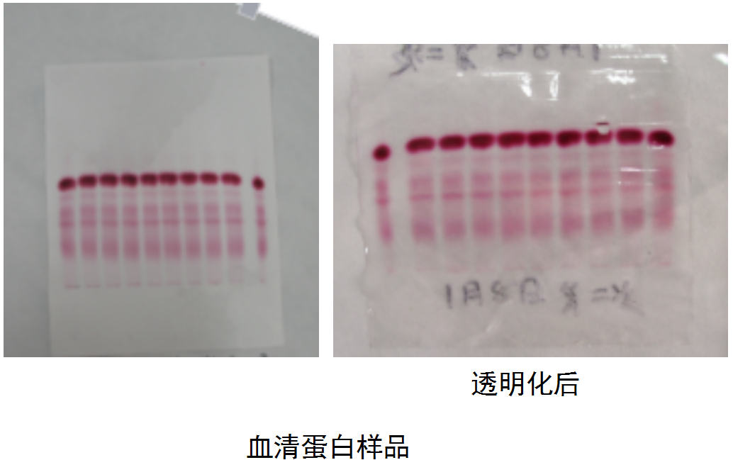 北京六一電泳小知識(shí)-電泳分類